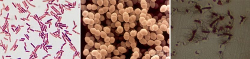 E. coli, fekálne enterokoky a proteus sú hlavnými pôvodcami chronickej bakteriálnej prostatitídy